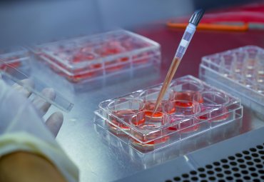 Estudio de la PUCV investigó cómo la obesidad podría favorecer el avance del cáncer de mama