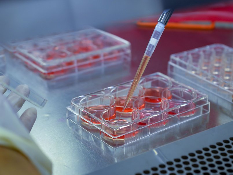Estudio de la PUCV investigó cómo la obesidad podría favorecer el avance del cáncer de mama