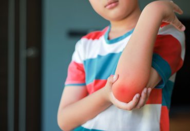 Study at the PUCV reveals key connection between child obesity, physical performance and bone health