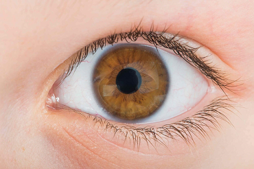 Infarto Ocular un peligro a la salud visual