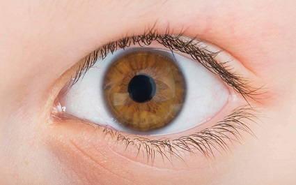 Infarto Ocular un peligro a la salud visual
